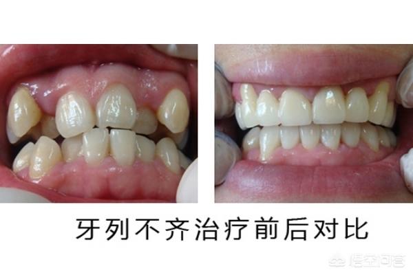 丽水最新24小时牙医在线咨询方法分析(最方便真实的丽水有没有24小时牙医方法)